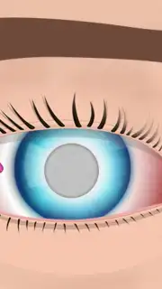 Eye Surgery captura 5