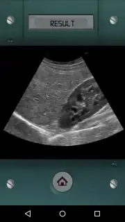 Scanner X-ray captura 3