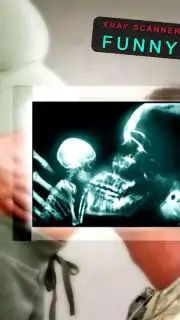 веселые рентгеновские лучи captura 3